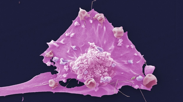 cell-breast-cancer.jpg