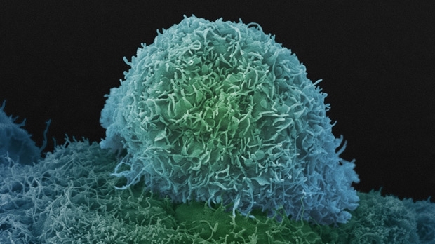 cell-prostate-cancer_0.jpg