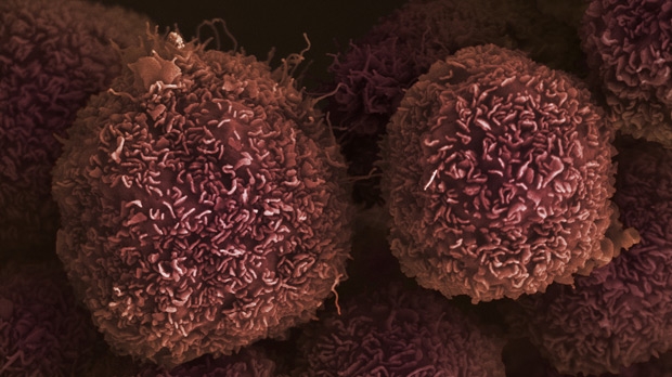 cell-pancreatic-cancer.jpg