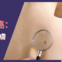 預防皮膚癌：保護皮膚小貼士