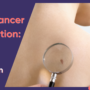Skin Cancer Prevention: Tips to Protect Your Skin