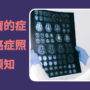 腦腫瘤的症狀與癌症照護者須知